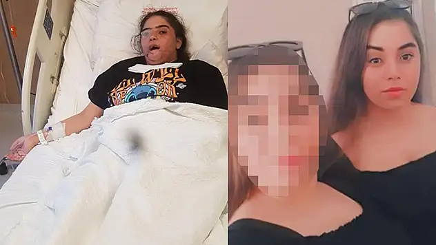 Depremde çenesini kaybetmişti! Genç kızın tek hayali tekrar konuşabilmek
