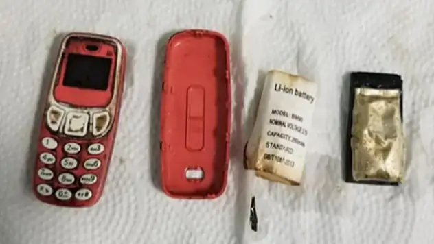Doktorları şaşırtan ameliyat: Hastanın midesinden Nokia 3310 çıktı
