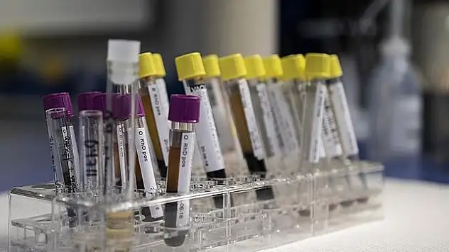 DSÖ: Avrupa ve ABD'de en az 169 'gizemli hepatit' vakası var