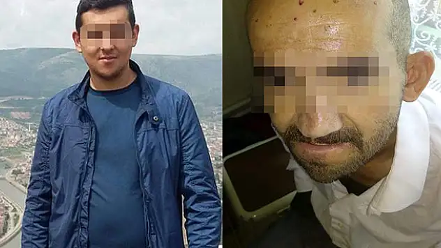 Engelli vatandaşın kafasında sigara söndüren şahsa ilginç ceza