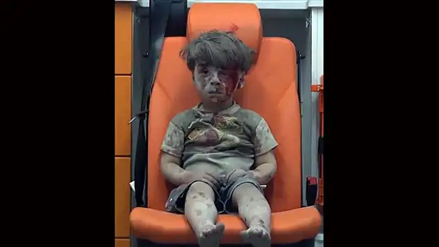 Enkazdan kurtarılan Suriyeli çocuğun insanlığı utandıran görüntüsü