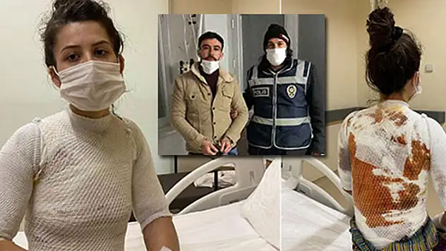 Eşi ve kızının üzerine kaynar su döken kişiye verilen 3 yıl 9 ay hapis cezasına itiraz edildi

