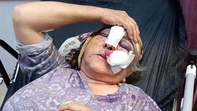 Eşiyle tartışan damat, konuşmak için gelen kayınvalidesi ve kayınpederini darbetti
