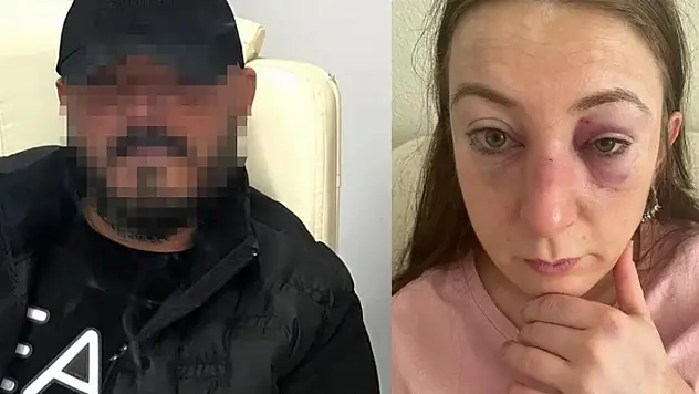 Eski erkek arkadaşı kabusu oldu! Genç kadın feci şekilde darp edildi

