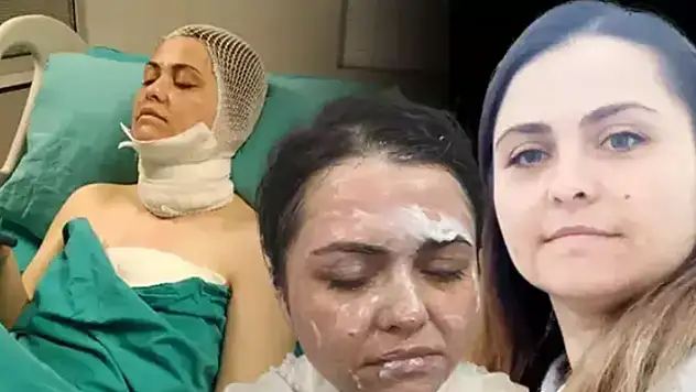 Eski eşe kimyasal maddeli saldırıda ceza belli oldu
