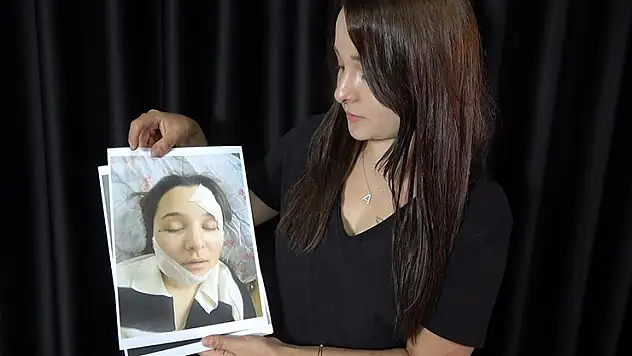 Eski sevgilisi tarafından öldüresiye darp edilen genç kadın yaşadığı kâbusu anlattı