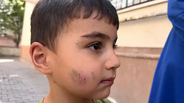 Evde uyuyan çocuğu lağım faresi ısırdı