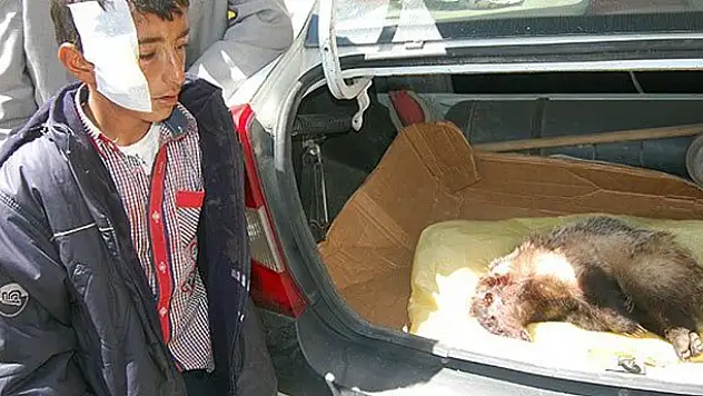 Eve giren porsuk çocuğun yanağını ve parmağını koparttı