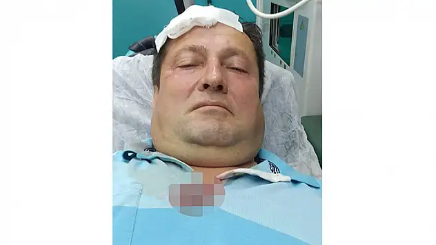 Evinin balkonunda otururken başına isabet eden 'yorgun mermi' ile yaralandı
