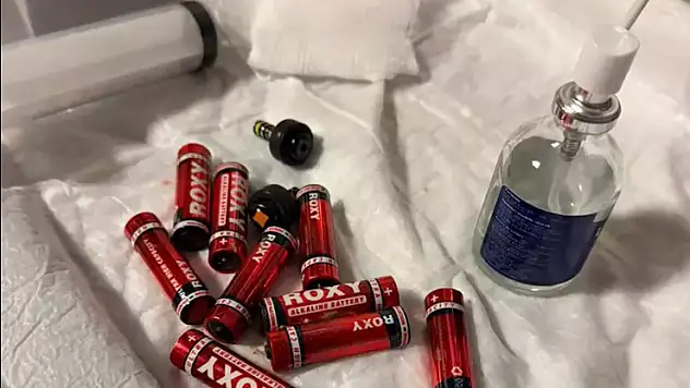 Cezaevindeki mahkumun midesinden çıkanlar şoke etti: 9 pil, 3 jilet