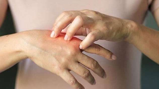 Fenomenlerin kozmetik ürünleri sağlık problemlerinin artışına neden oldu
