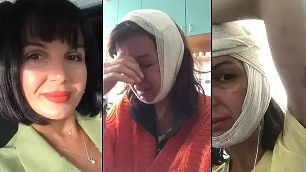 Güzellik salonunda topuklu ayakkabı dayağı! 'Boks torbasını yumruklar gibi suratına vurmuş'
