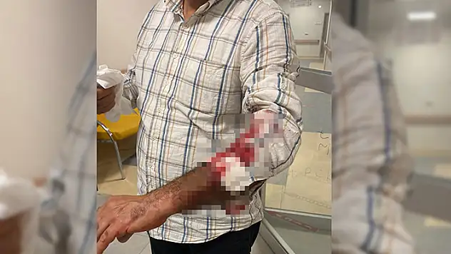 Hatay'da sahipsiz köpeklerin saldırdığı kişi yaralandı
