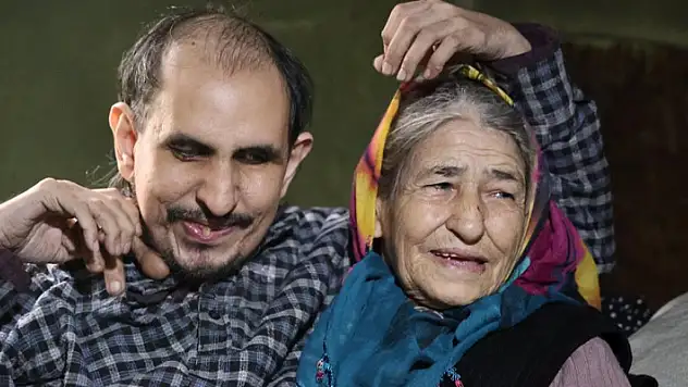 Hayatta kalan tek oğluna 40 yıldır bebek gibi bakıyor
