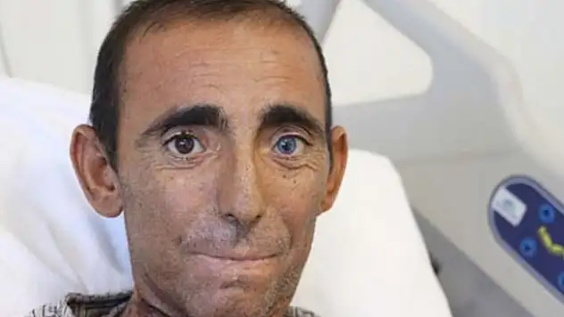 Herkes de 2 onda 5 tane var!