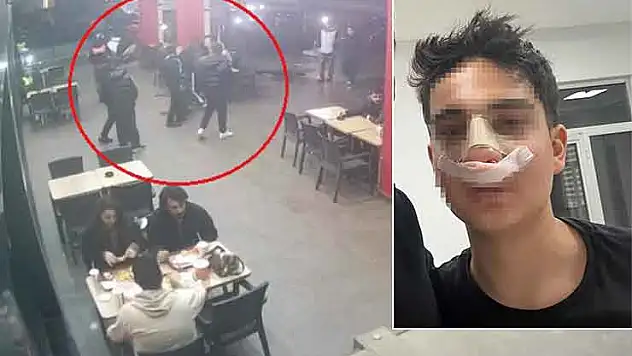 Hiç tanımadıkları genci 'Neden bakıyorsun' diye darp edip burnunu kırdılar
