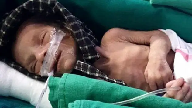 Hindistan'da canlı halde gömülmüş kız bebek bulundu
