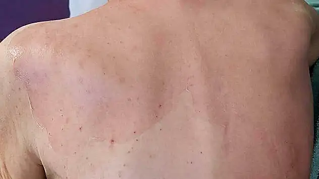 Huzurevinde ölümde, sanık doktor hakkında yakalama kararı