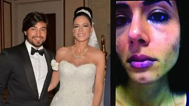 İbrahim Toraman, Eylem Toraman'a 6 ay yaklaşamayacak