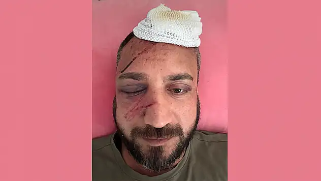 'İcraya verdiği eski sevgilisinin ailesi tarafından öldüresiye darp edildi' iddiası