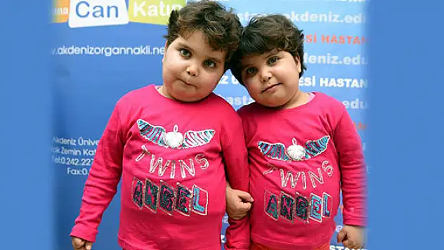 İkizler organ nakli ile hayat buldu