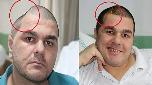 İnanılmaz değişim!