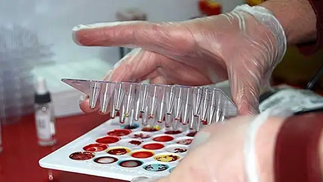 İngiltere'de her iki kişiden biri kanser olacak