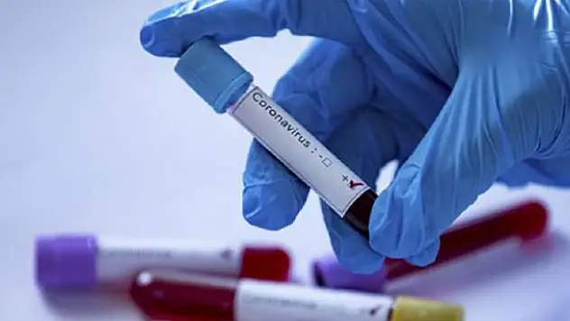İngiltere'nin Çin'den aldığı test kitleri virüslü çıktı