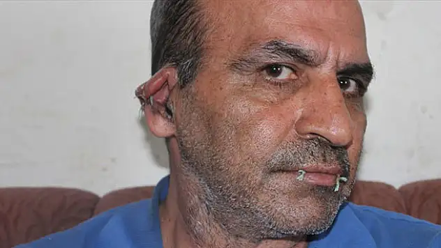 İranlı sığınmacı ağzını ve kulaklarını dikti