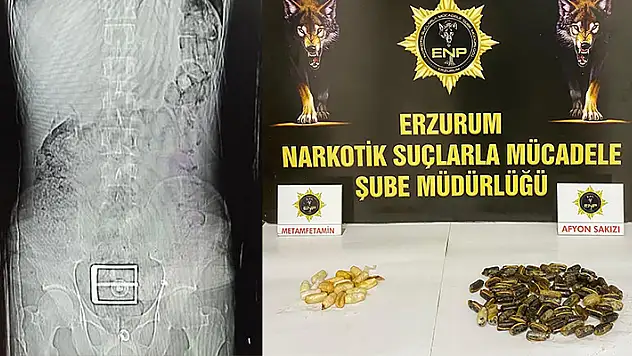 İranlı şüphelinin mide ve bağırsağından uyuşturucu çıktı

