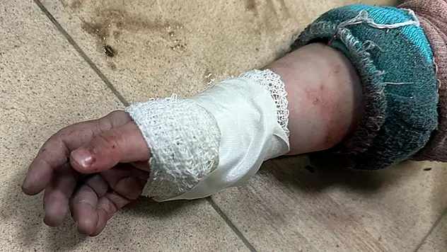 İsrail'in saldırılarında yaralanan 50 Gazzeli çocuk Kolombiya'da tedavi görecek
