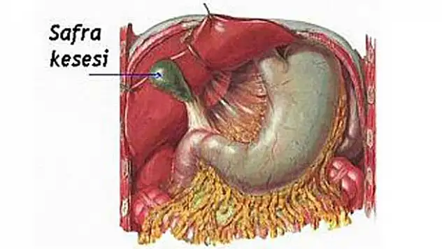 İşte safra kesesi hastalıklarının bilinmeyenleri