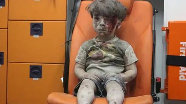 İşte Ümran Dakneş'in son hali