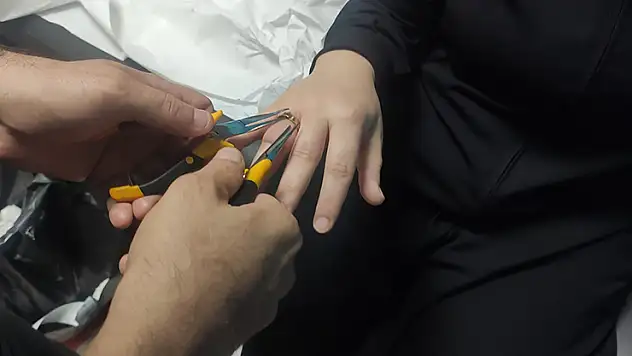 Kadının parmağına sıkışan yüzük, itfaiye ekibince hastanede çıkarıldı
