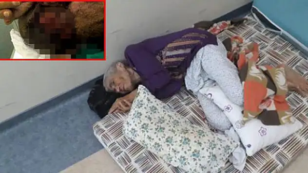 Kahramanmaraş'ta kafası kurtlanan hastanın görüntüleri ile gündeme gelen bakımevi hakkında soruşturma başlatıldı