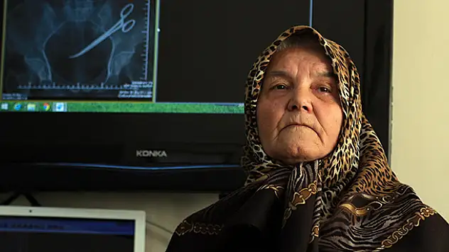Karnında unutulan makasla 5 yıl yaşadı
