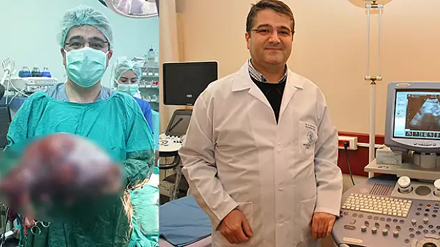 Karnından 10 kilogram kitle çıkartıldı