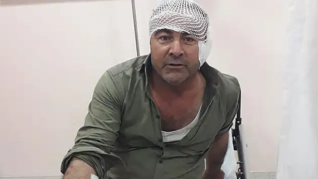 Kavga ettiği akrabasının kulağını kopardı