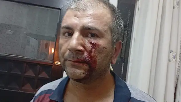 'Kenara çekilir misiniz' diyerek uyardı, dayak yedi