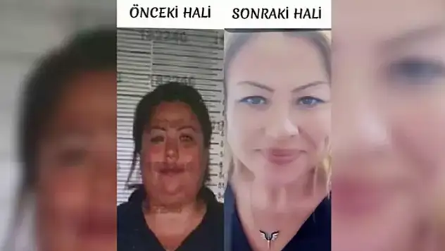 Kimliğini kullandığı kardeşine benzemek için estetik yaptıran şüpheliyi jandarma yakaladı