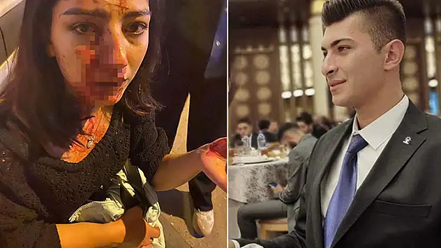 Kırşehir'de genç kızın burnunu kıran AK Parti Keskin Gençlik Kolları Başkanı Ünlüer, serbest bırakıldı

