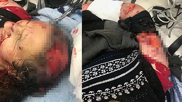Kırşehir'de köpek dehşeti! Saldırıya uğrayan kadın Konya'ya sevk edildi