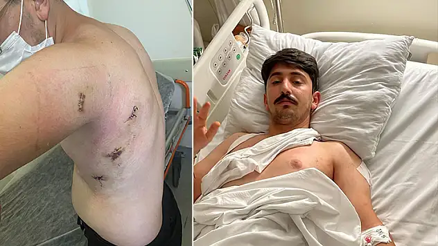 Kız kardeşini korumak isterken 5 yerinden bıçaklanmıştı: O anları anlattı: 'Ölümden döndüm'