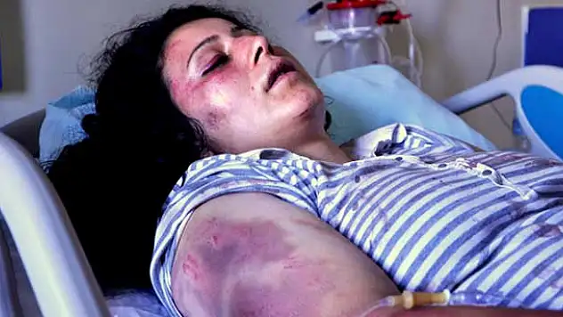 Koca şiddetinden kaçan genç kadın balkondan atladı