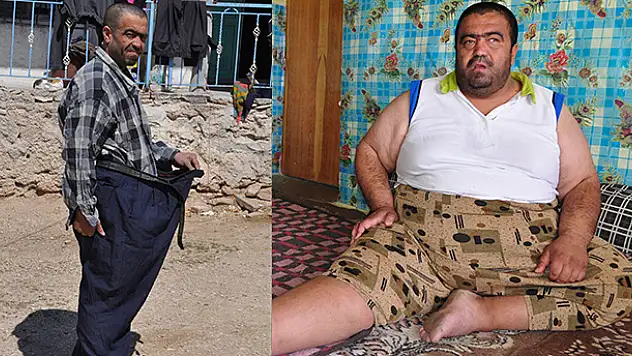Konya'da 184 kiloluk hasta iki yılda 90 kiloya düştü