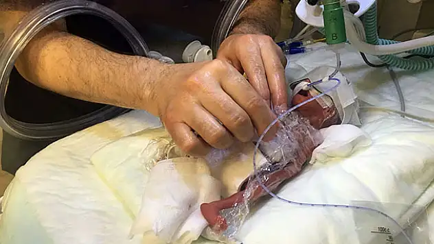 Konya'da 310 gram bebek dünyaya geldi