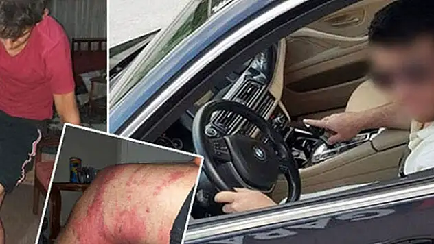 Konya'da çırağını 'triger kayışı' ile dövdüğü öne sürülen ustanın yargılanmasına devam edildi