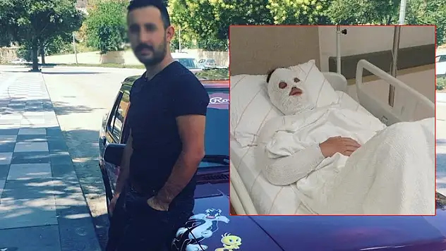 Konya'da eski nişanlısına kimyasal sıvı atan kişiye 15 yıl hapis cezası
