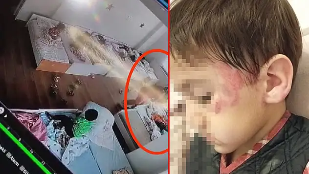 Konya'da inanılmaz olay! Anaokulunda 4 yaşındaki çocuk 3 yaşındaki çocuğu uyurken 13 yerinden ısırdı aile şikayetçi oldu