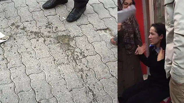 Konya'da kadının yüzüne bilinmeyen bir madde attılar